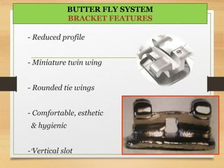 - Reduced profile
- Miniature twin wing
- Rounded tie wings
- Comfortable, esthetic
& hygienic
- Vertical slot 5-Jun-1647
BUTTER FLY SYSTEM
BRACKET FEATURES
 