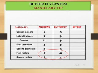 MAXILLARY ANDREWS BUTTERFLY OFFSET
Central incisors 5 5
Lateral incisors 9 9
Canines 11 9
First premolars 2 0
Second premolars 2 3
First molars 5 -6
Second molars 5 -
5-Jun-16 48
BUTTER FLY SYSTEM
MAXILLARY TIP
 