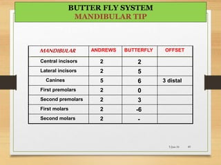 MANDIBULAR ANDREWS BUTTERFLY OFFSET
Central incisors 2 2
Lateral incisors 2 5
Canines 5 6 3 distal
First premolars 2 0
Second premolars 2 3
First molars 2 -6
Second molars 2 -
5-Jun-16 49
BUTTER FLY SYSTEM
MANDIBULAR TIP
 