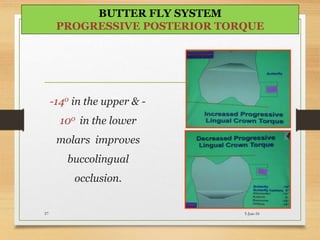 -140 in the upper & -
100 in the lower
molars improves
buccolingual
occlusion.
5-Jun-1657
BUTTER FLY SYSTEM
PROGRESSIVE POSTERIOR TORQUE
 