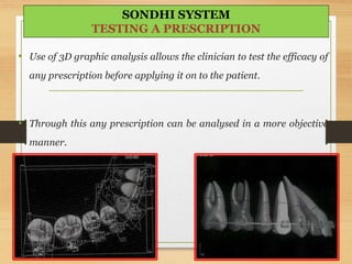 • Use of 3D graphic analysis allows the clinician to test the efficacy of
any prescription before applying it on to the patient.
• Through this any prescription can be analysed in a more objective
manner.
5-Jun-1662
SONDHI SYSTEM
TESTING A PRESCRIPTION
 