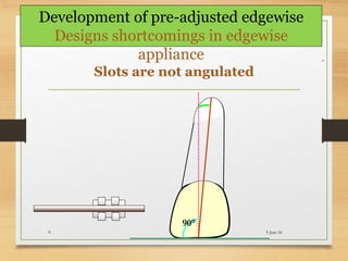 Slots are not angulated
90°
5-Jun-169
Development of pre-adjusted edgewise
Designs shortcomings in edgewise
appliance
 