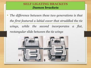 • The difference between these two generations is that
the first featured a labial cover that straddled the tie
wings, while the second incorporates a flat,
rectangular slide between the tie wings
96
SELF LIGATING BRACKETS
Damon brackets
 