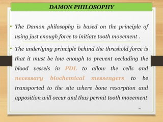 • The Damon philosophy is based on the principle of
using just enough force to initiate tooth movement .
• The underlying principle behind the threshold force is
that it must be low enough to prevent occluding the
blood vessels in PDL to allow the cells and
necessary biochemical messengers to be
transported to the site where bone resorption and
apposition will occur and thus permit tooth movement
98
DAMON PHILOSOPHY
 
