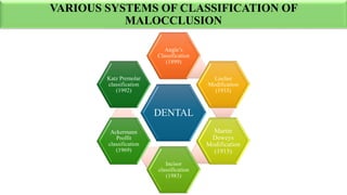 Recent Trends in the classification of Malocclusion.pdf