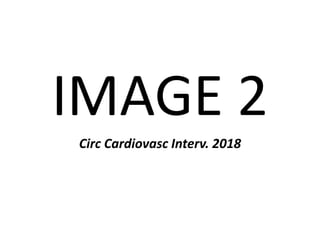 IMAGE 2
Circ Cardiovasc Interv. 2018
 