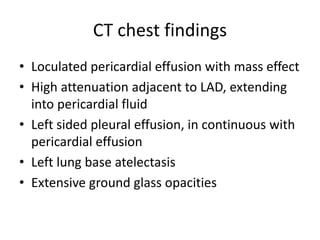 CT chest findings
• Loculated pericardial effusion with mass effect
• High attenuation adjacent to LAD, extending
into pericardial fluid
• Left sided pleural effusion, in continuous with
pericardial effusion
• Left lung base atelectasis
• Extensive ground glass opacities
 