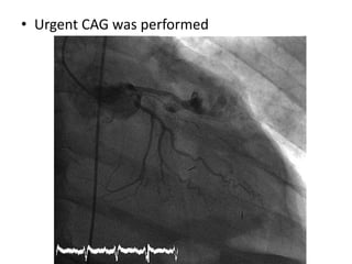 • Urgent CAG was performed
 