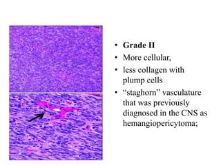 • Grade II
• More cellular,
• less collagen with
plump cells
• “staghorn” vasculature
that was previously
diagnosed in the CNS as
hemangiopericytoma;
 