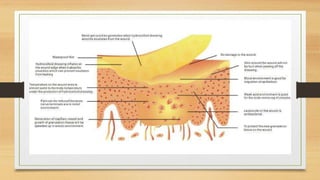 Contiguous Wound Recent wound therapy.pptx