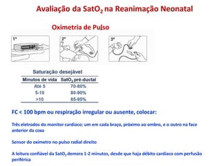 Avaliação da SatO2 na Reanimação Neonatal
FC < 100 bpm ou respiração irregular ou ausente, colocar:
Três eletrodos do monitor cardíaco: um em cada braço, próximo ao ombro, e o outro na face
anterior da coxa
Sensor do oxímetro no pulso radial direito
A leitura confiável da SatO2 demora 1-2 minutos, desde que haja débito cardíaco com perfusão
periférica
Oximetria de Pulso
 