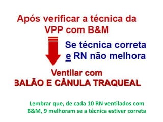 Lembrar que, de cada 10 RN ventilados com
B&M, 9 melhoram se a técnica estiver correta
 