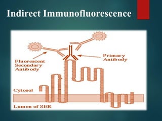 Indirect Immunofluorescence
 