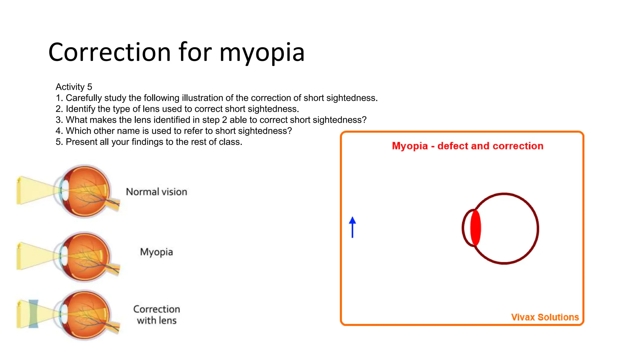 Correction for myopia
Activity 5
1. Carefully study the following illustration of the correction of short sightedness.
2. Identify the type of lens used to correct short sightedness.
3. What makes the lens identified in step 2 able to correct short sightedness?
4. Which other name is used to refer to short sightedness?
5. Present all your findings to the rest of class.
 
