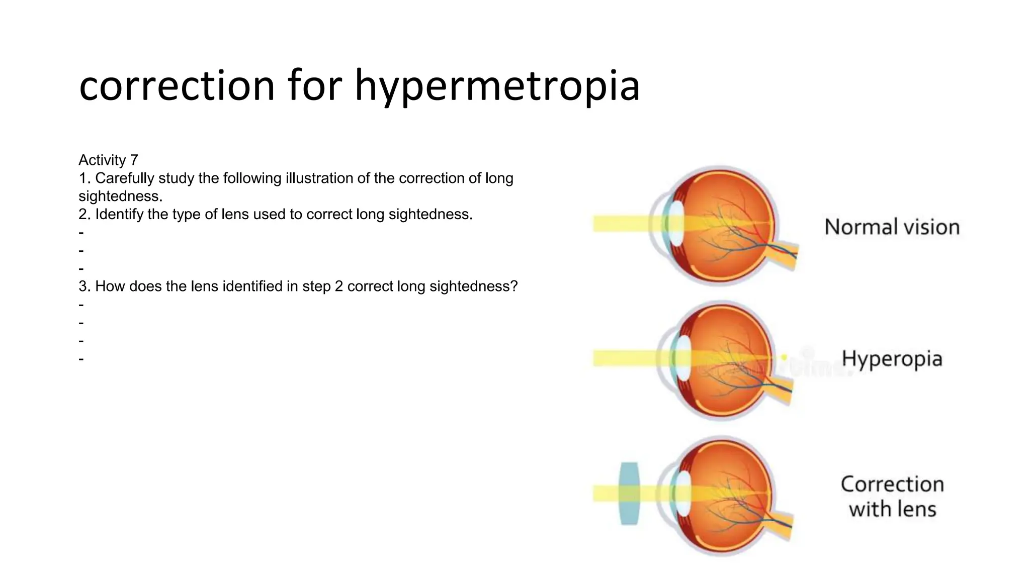 correction for hypermetropia
Activity 7
1. Carefully study the following illustration of the correction of long
sightedness.
2. Identify the type of lens used to correct long sightedness.
-
-
-
3. How does the lens identified in step 2 correct long sightedness?
-
-
-
-
 
