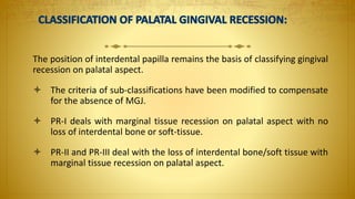 The position of interdental papilla remains the basis of classifying gingival
recession on palatal aspect.
 The criteria of sub-classifications have been modified to compensate
for the absence of MGJ.
 PR-I deals with marginal tissue recession on palatal aspect with no
loss of interdental bone or soft-tissue.
 PR-II and PR-III deal with the loss of interdental bone/soft tissue with
marginal tissue recession on palatal aspect.
 