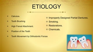 ETIOLOGY
 Calculus.
 Tooth Brushing
 High Frenal Attachment.
 Position of the Tooth
 Tooth Movement by Orthodontic Forces
 Improperly Designed Partial Dentures.
 Smoking.
 Restorations.
 Chemicals.
 