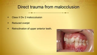 Direct trauma from malocclusion
 Class II Div 2 malocculusion
 Reduced overjet
 Retroclination of upper anterior teeth.
 