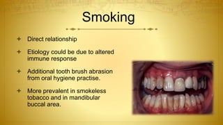 Smoking
 Direct relationship
 Etiology could be due to altered
immune response
 Additional tooth brush abrasion
from oral hygiene practise.
 More prevalent in smokeless
tobacco and in mandibular
buccal area.
 