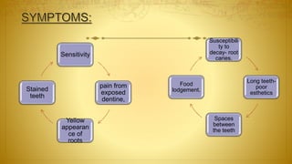 Sensitivity
pain from
exposed
dentine,
Yellow
appearan
ce of
roots
Stained
teeth
Susceptibili
ty to
decay- root
caries.
Long teeth-
poor
esthetics
Spaces
between
the teeth
Food
lodgement.
 