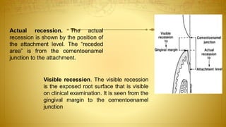 Actual recession. The actual
recession is shown by the position of
the attachment level. The “receded
area” is from the cementoenamel
junction to the attachment.
Visible recession. The visible recession
is the exposed root surface that is visible
on clinical examination. It is seen from the
gingival margin to the cementoenamel
junction
 