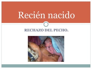 RECHAZO DEL PECHO. Recién nacido 