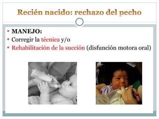 MANEJO: Corregir la  técnica  y/o Rehabilitación de la succión  (disfunción motora oral) 