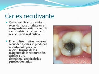 Caries recidivante
 Caries recidivante o caries
  secundaria, se produce en el
  margen de un restauración, la
  cual a sufrido un desajuste o
  se encuentra mal pulida.

 En estudios in vitro de caries
  secundaria, estas se producen
  inicialmente por una
  microfiltración de los
  márgenes de la restauración,
  debido a una
  desmineralización de las
  paredes dentarias.
 