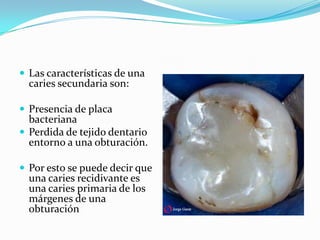  Las características de una
  caries secundaria son:

 Presencia de placa
  bacteriana
 Perdida de tejido dentario
  entorno a una obturación.

 Por esto se puede decir que
  una caries recidivante es
  una caries primaria de los
  márgenes de una
  obturación
 