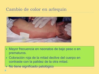 Características del recién nacido normal | PPTX