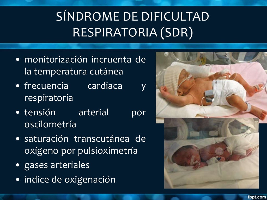 Recien nacido con dificultad respiratoria Enfoque diagnóstico y tera… Recien nacido con dificultad respiratoria Enfoque diagnóstico y tera…