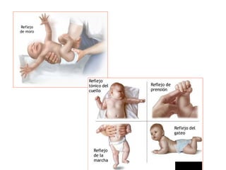 Recien nacido normal 