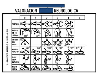 Recien nacido normal 