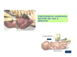 FRECUENCIA CARDIACA
MAYOR DE 100 X
MINUTO
 