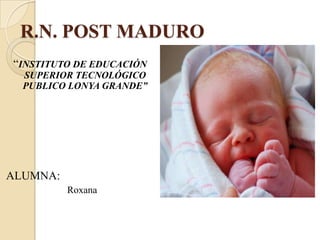 R.N. POST MADURO
“INSTITUTO DE EDUCACIÓN
SUPERIOR TECNOLÓGICO
PUBLICO LONYA GRANDE”
ALUMNA:
Roxana
 