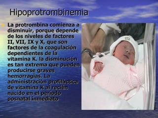 Hipoprotrombinemia La protrombina comienza a disminuir, porque depende de los niveles de factores II, VII, IX y X, que son factores de la coagulación dependientes de la vitamina K. la disminución es tan extrema que pueden producirse graves hemorragias. La administración profiláctica de vitamina K al recién nacido en el período posnatal inmediato  