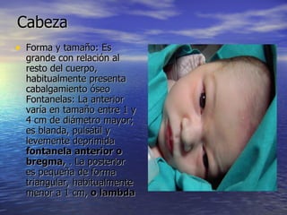 Cabeza Forma y tamaño: Es grande con relación al resto del cuerpo, habitualmente presenta  cabalgamiento óseo Fontanelas: La anterior varía en tamaño entre 1 y 4 cm de diámetro mayor; es blanda, pulsátil y levemente deprimida  fontanela anterior o bregma,  . La posterior es pequeña de forma triangular, habitualmente menor a 1 cm,  o lambda   
