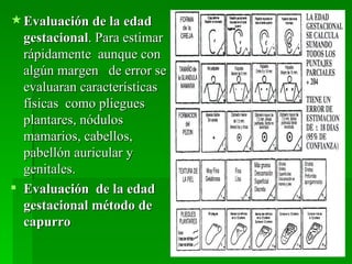  Evaluación de la edad
  gestacional. Para estimar
  rápidamente aunque con
  algún margen de error se
  evaluaran características
  físicas como pliegues
  plantares, nódulos
  mamarios, cabellos,
  pabellón auricular y
  genitales.
 Evaluación de la edad
  gestacional método de
  capurro
 