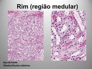 Rim (região medular)Alça de henleTúbulos/Ductoscoletores
