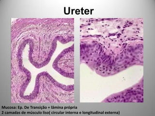 UreterMucosa: Ep. De Transição + lâmina própria2 camadas de músculo liso( circular interna e longitudinal externa)