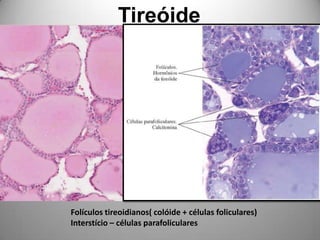 TireóideFolículos tireoidianos( colóide + células foliculares)Interstício – células parafoliculares