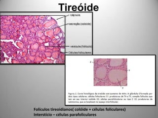 TireóideFolículos tireoidianos( colóide + células foliculares)Interstício – células parafoliculares
