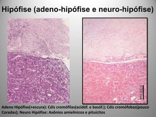 Hipófise (adeno-hipófise e neuro-hipófise)Adeno Hipófise(+escura): Célscromófilas(acidóf. e basóf.); Célscromófobas(pouco Coradas); Neuro Hipófise: Axônios amielínicos e pituícitos