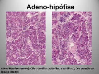Adeno-hipófiseAdeno Hipófise(+escura): Célscromófilas(acidófilas. e basófilas.); Célscromófobas(pouco coradas)