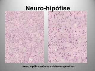 Neuro-hipófiseNeuro Hipófise: Axônios amielínicos e pituícitos