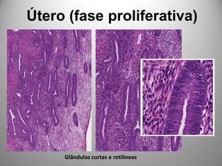 Útero (fase proliferativa)Glândulas curtas e retilíneas