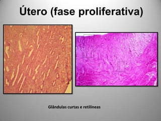 Útero (fase proliferativa)Glândulas curtas e retilíneas