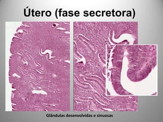 Útero (fase secretora)Glândulas desenvolvidas e sinuosas
