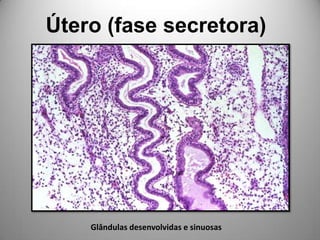 Útero (fase secretora)Glândulas desenvolvidas e sinuosas