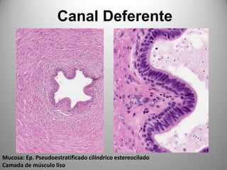 Canal DeferenteMucosa: Ep. Pseudoestratificado cilíndrico estereociladoCamada de músculo liso